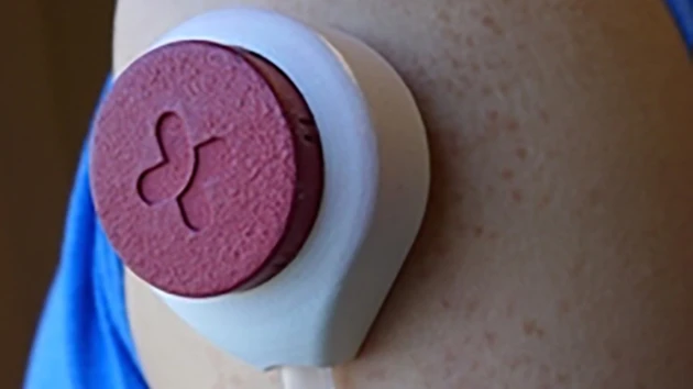 The HemoLink device can draw enough blood for certain routine tests without the need for needles (Photo: David Tenenbaum)