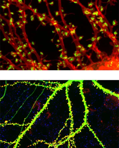 Synapses visualized in live neurons using fluorescent proteins