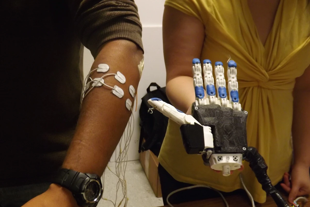 A US$270 programmable, 3D-printed electromyographic prosthetic hand may soon change the lives of amputees in Ecuador and elsewhere around the world (Photo: University of Illinois at Urbana-Champaign)