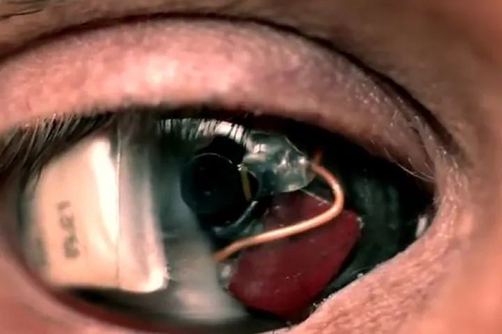Film-maker Rob Spence has announced that his 'Camera Eye' is now fully functioning (Image: Rob Spence)