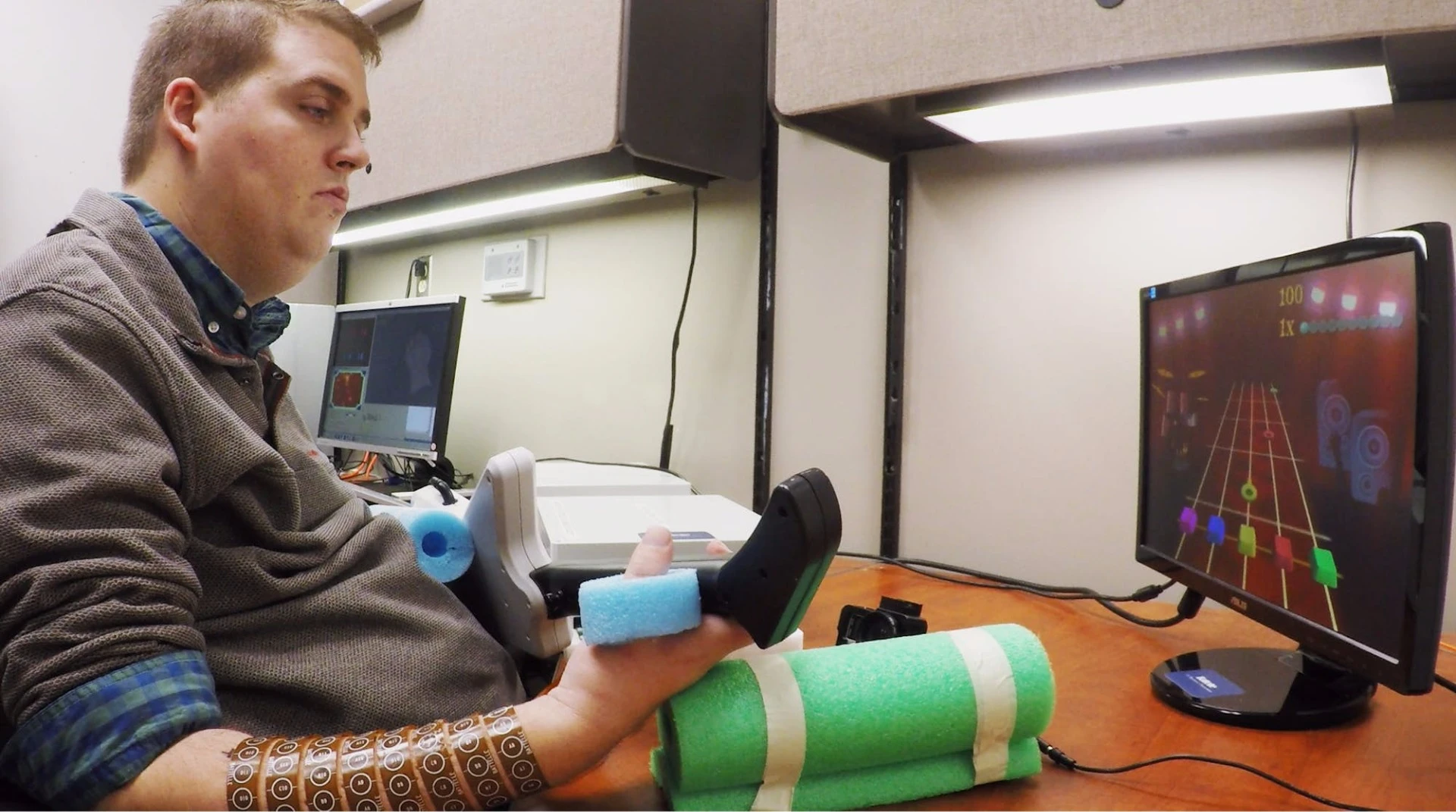 26-year-old Ian Burkhart had suffered a diving injury at age 19 that left him quadriplegic, but now has a chip in his brain that allows him to use his hands