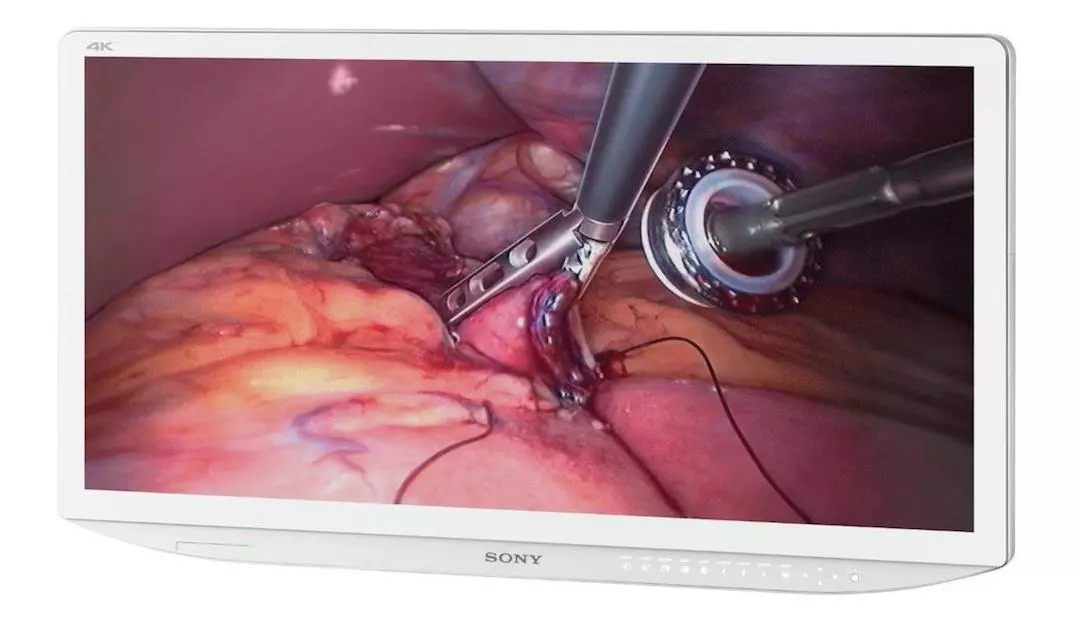 Sony has unveiled a new line of medical monitors and recorders, including the first to combine 3D imagery with 4K resolution
