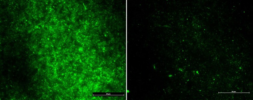 Before (L) and after (R) images show the population of bacteria (green) was drastically reduced following the application of the an electrified scaffold