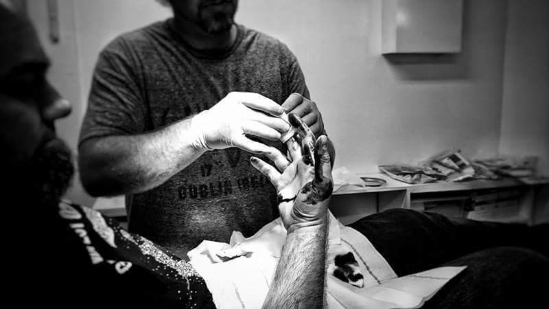 Lee undergoing a surgical procedure to enhance his body with technology, a process known as grinding