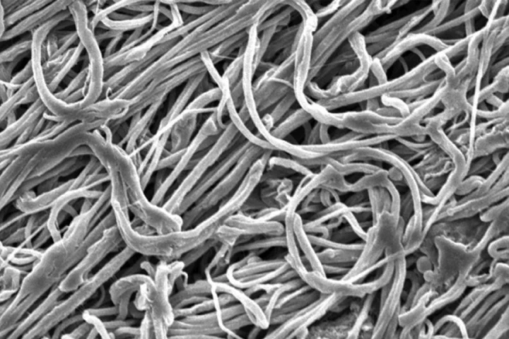 A scanning electron microscope image of the gel-electrospun nanofibers