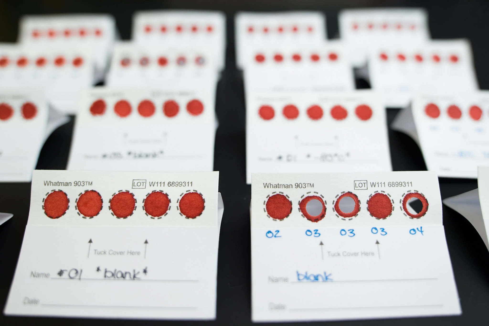 A dried blood spot analysis that can detect B12 levels has been developed