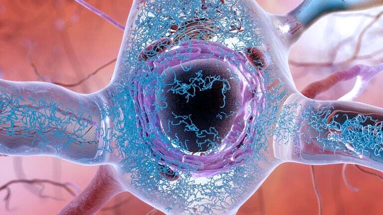 New insights into the shape of toxic tau proteins before they form neuron-destroying tangles could lead to an early diagnostic method for Alzheimer's