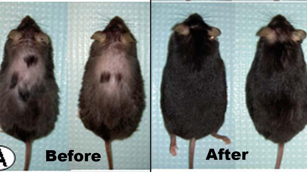 Researchers stumble on potential new treatment for hair loss