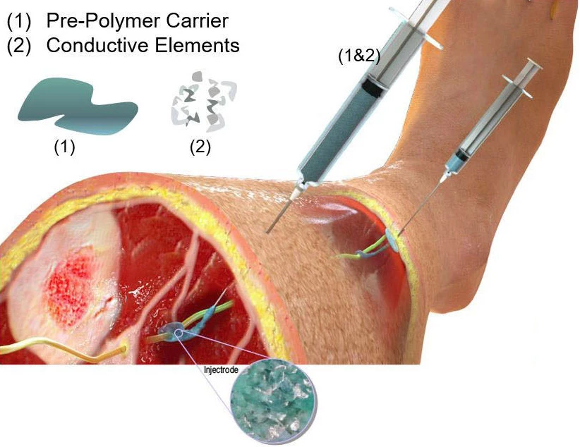 A diagram of the injectrode system