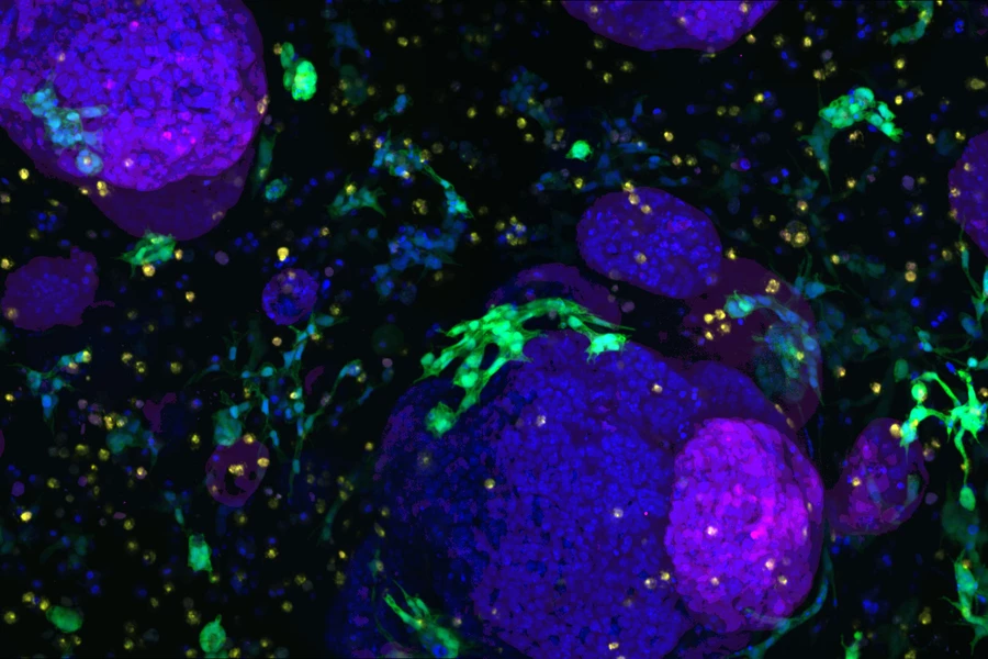 Fibroblasts (green) and macrophages (orange) act as support cells around lab-grown pancreatic organoids