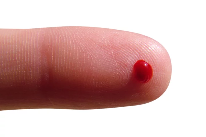 TBIcheck can diagnose traumatic brain injury using a single drop of blood