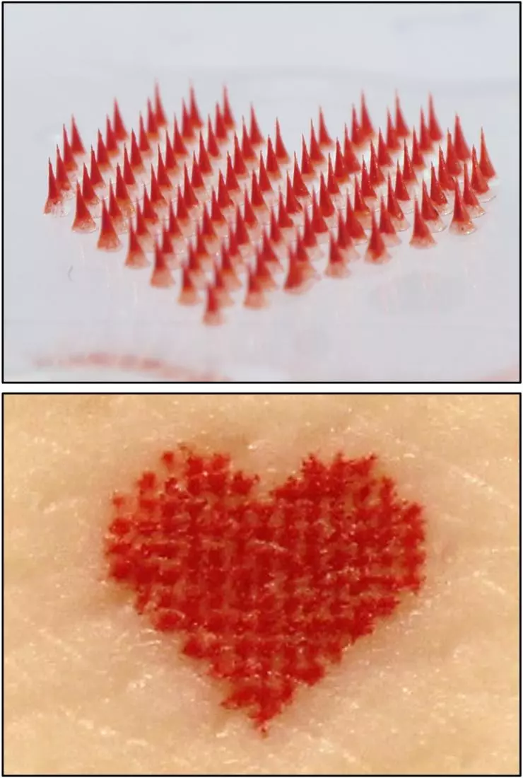 Simple heart-shaped designs were proposed for medical uses