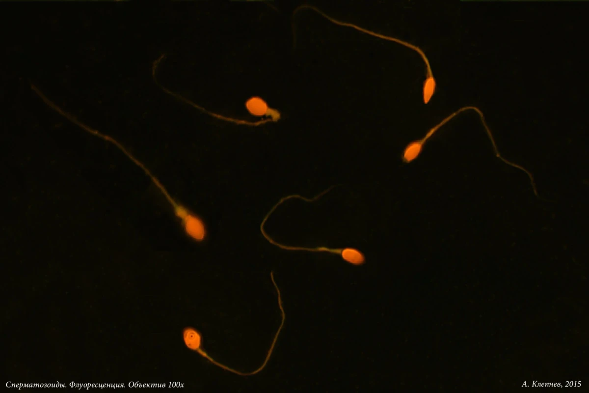 The findings may also have implications for the treatment of male infertility