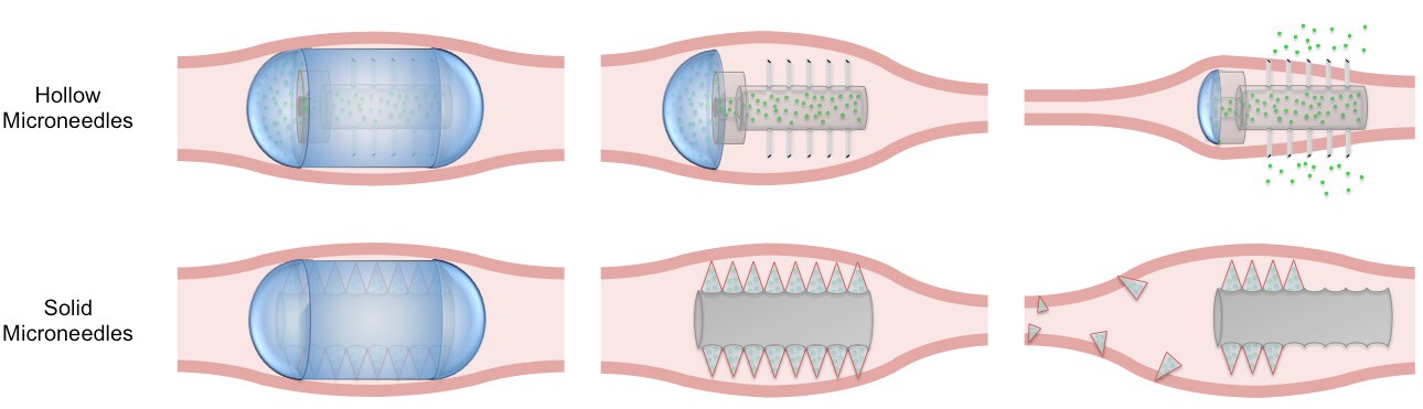 The team is working on two designs for the capsule, one with fixed hollow needles and another with solid needles designed to break away and embed themselves in the intestinal wall (Image: MIT)