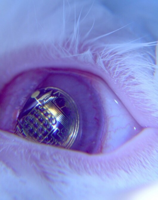 Electronic Contact Lens promises bionic capabilities for everyone