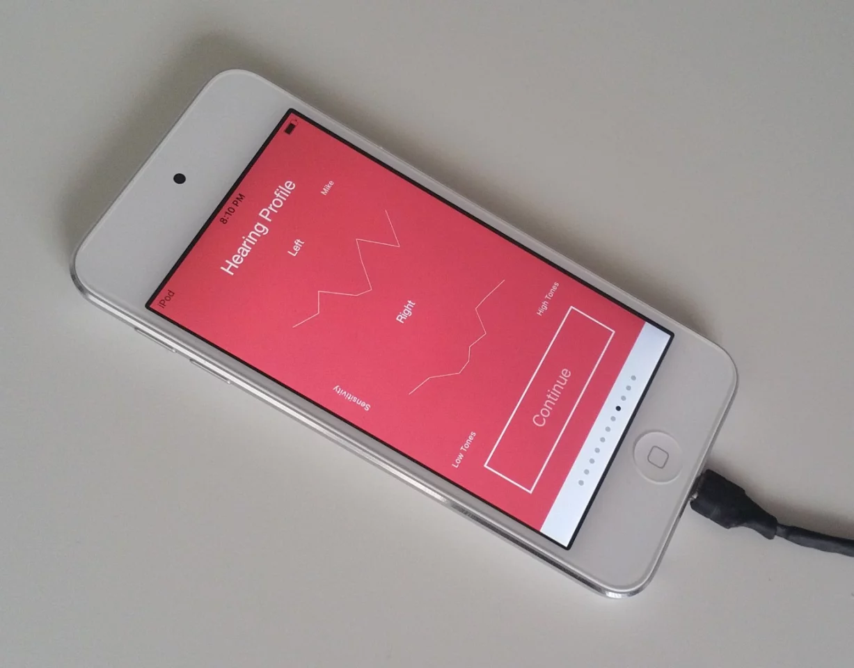 Mike Irving's hearing profile as measured by the Nura phones