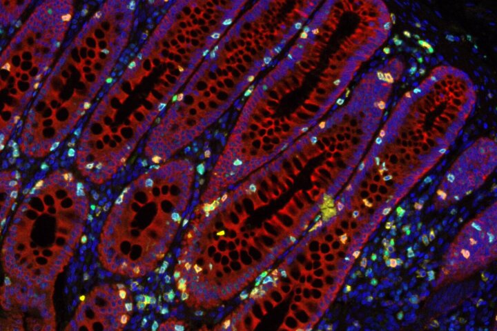 The discovery could help vastly improve patient outcomes and survival rate for cancer sufferers