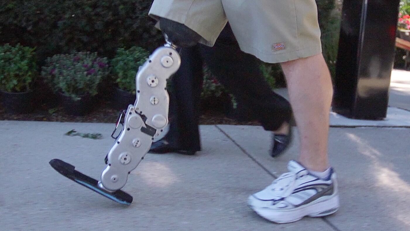 The U.S. Department of Defense is investing US$8 million dollars to develop a functional bionic leg