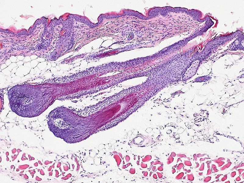 Histological analyses of bioengineered vibrissa follicles
