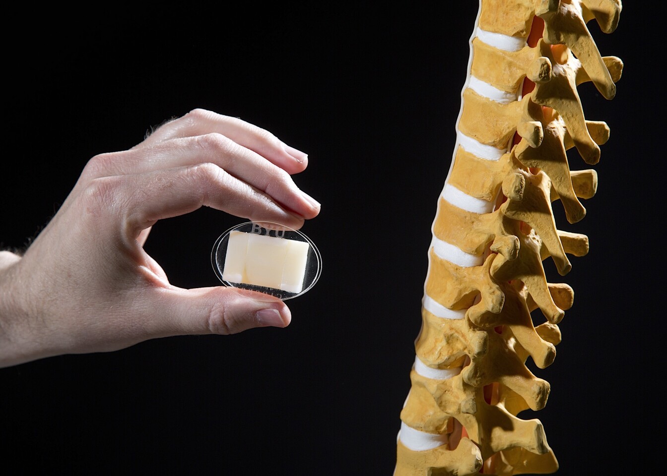 Artificial spinal disc designed to treat chronic lower back pain