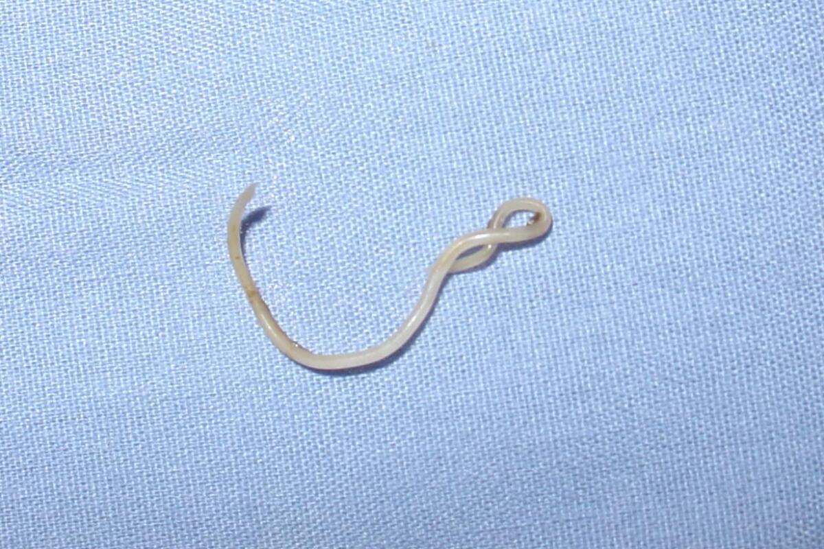 Как выглядят токсокары у кошек Scientists sequence genetic code of dog roundworm