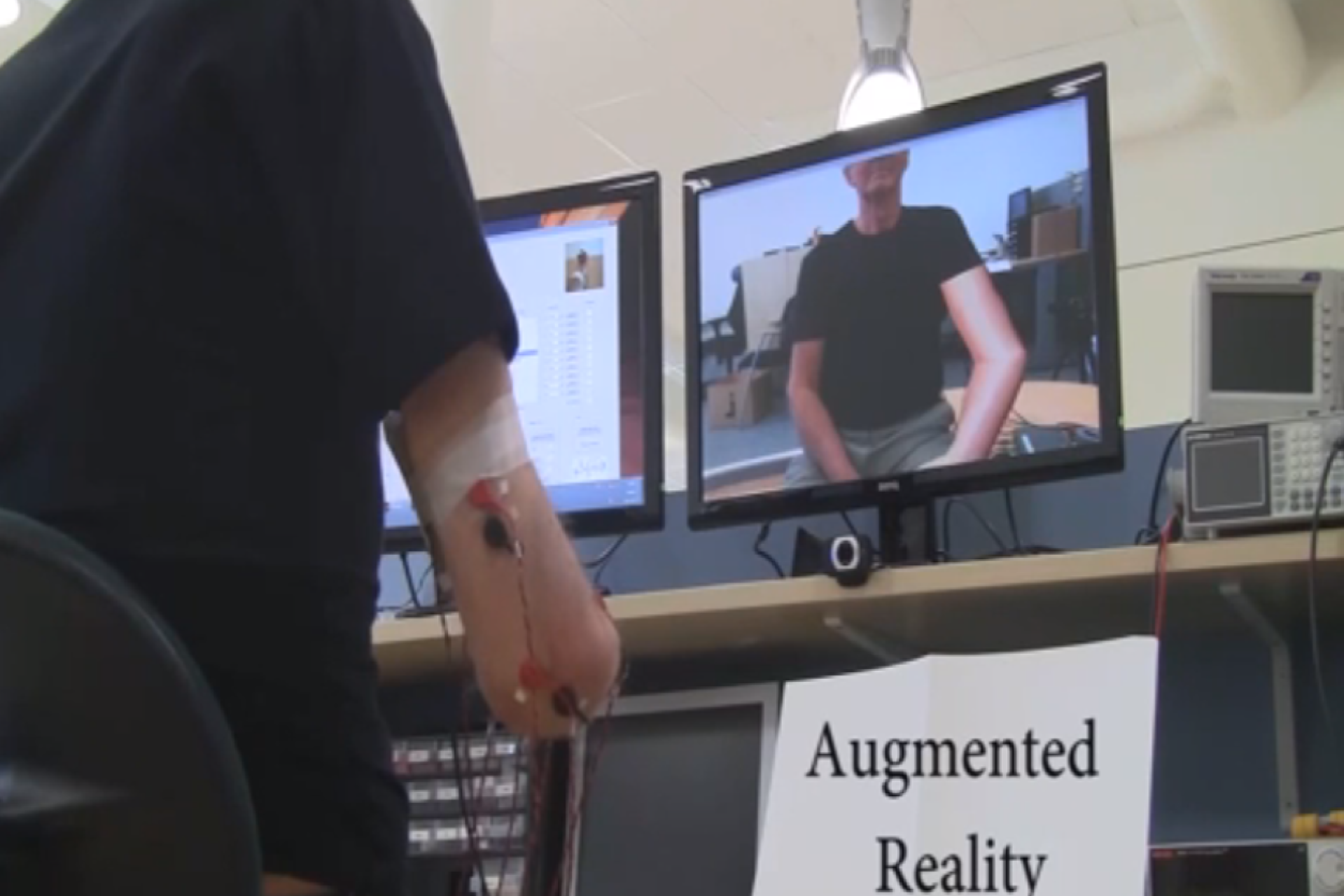 Ампутированные конечности. Фантомные боли при ампутации ноги. Профилактика фантомных болей. Протезы после ампутации конечностей. Фантомные боли при ампутации.