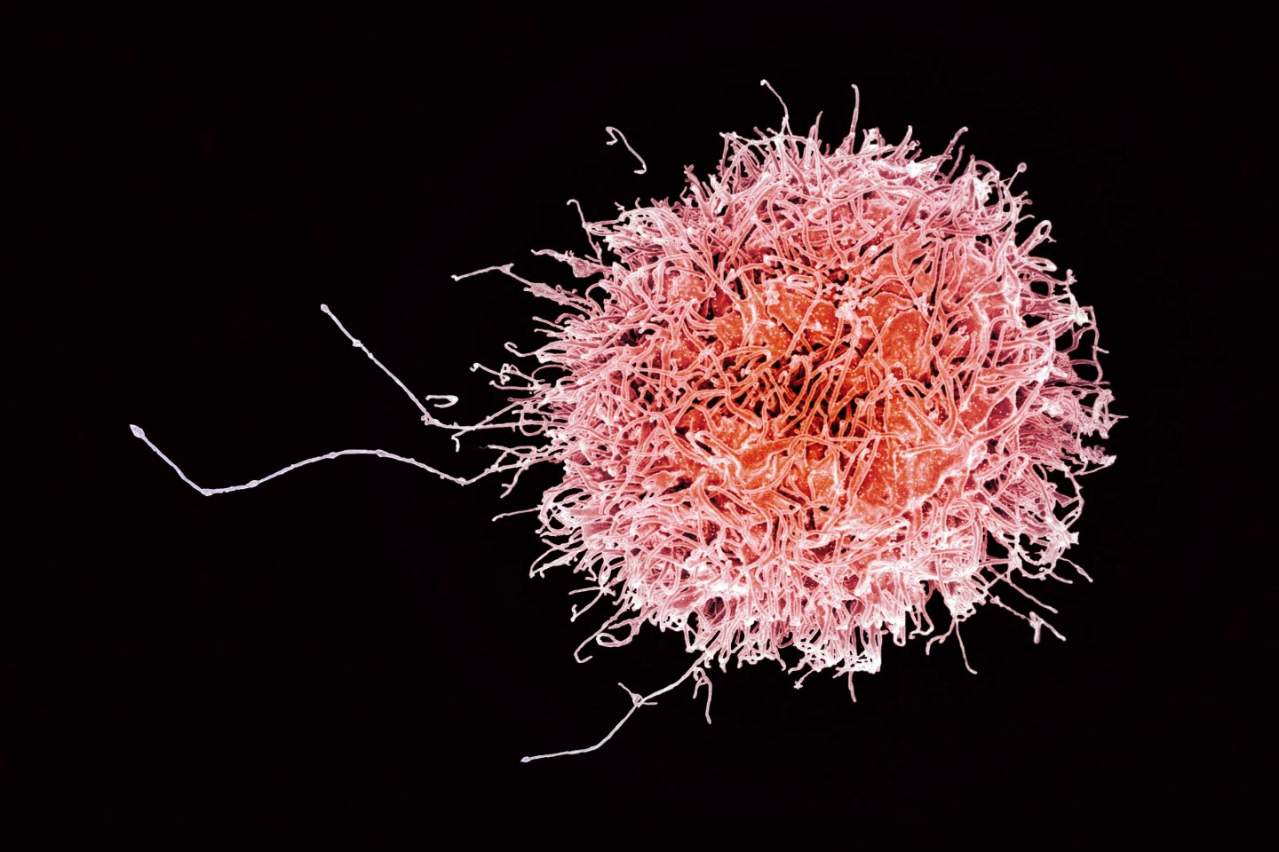 Removing the cancer's sugary disguise enables natural killer cells like this one to target tumors