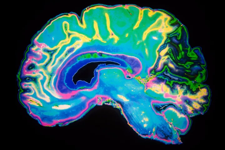 A new Harvard study offers another clue into the neurological foundation of psychopathic behavior