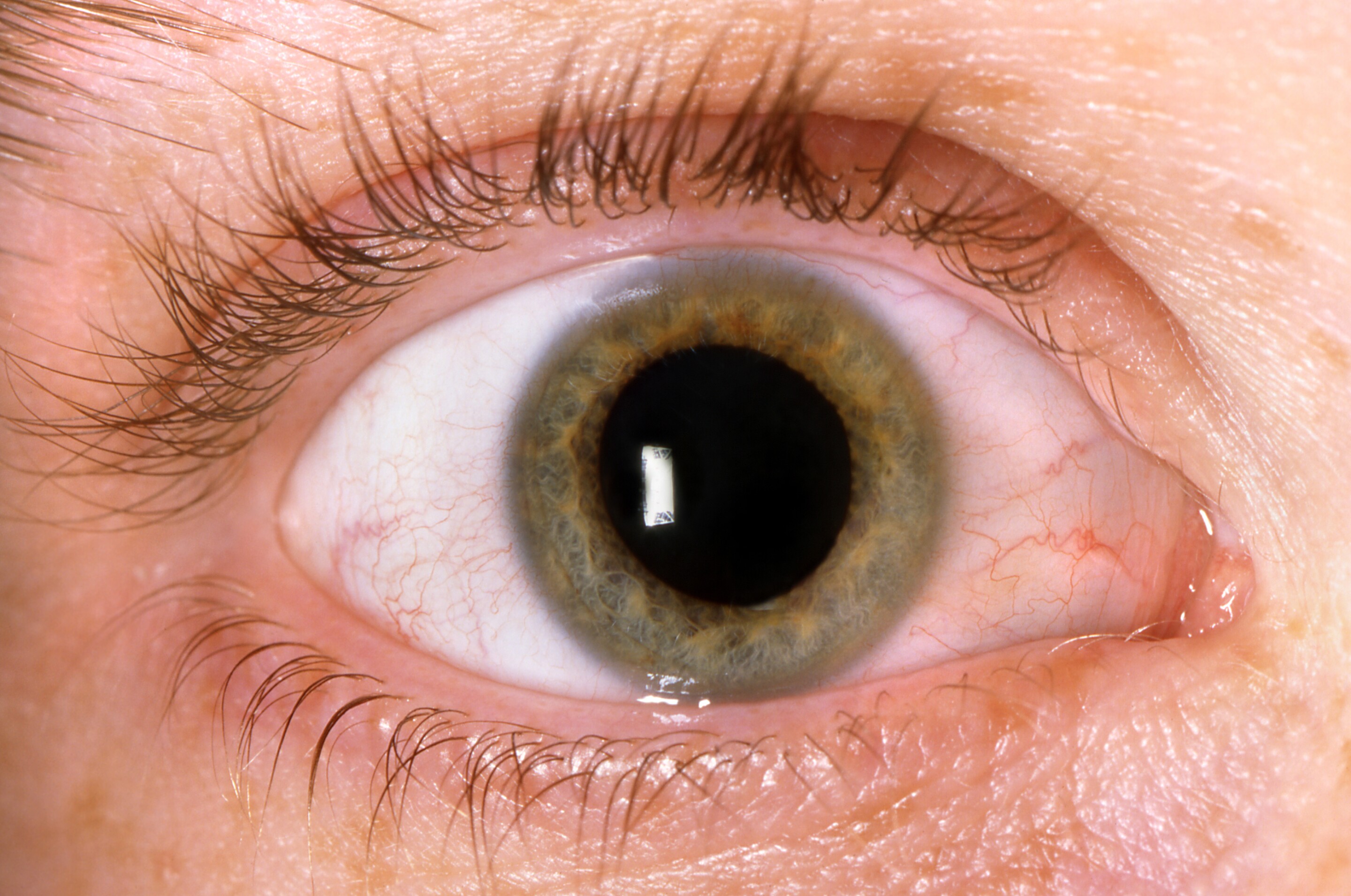 Pupil size found to vary based on number of objects you re looking at Pupil size found to vary based on number of objects you re looking at