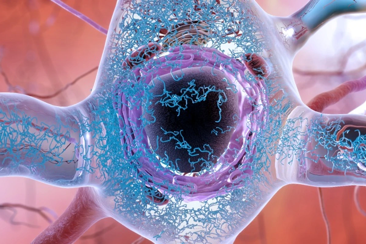 New insights into the shape of toxic tau proteins before they form neuron-destroying tangles could lead to an early diagnostic method for Alzheimer's