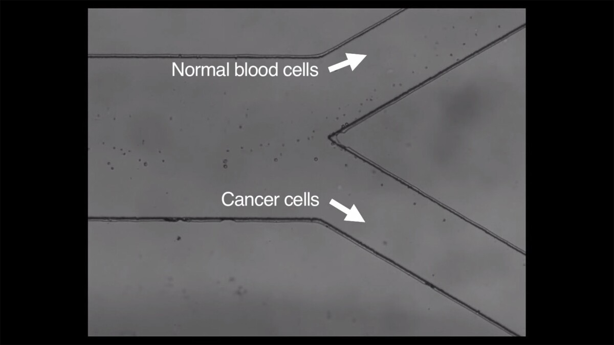 The new version of the method allows for gentle sorting of cells in patient blood samples (Image: MIT)