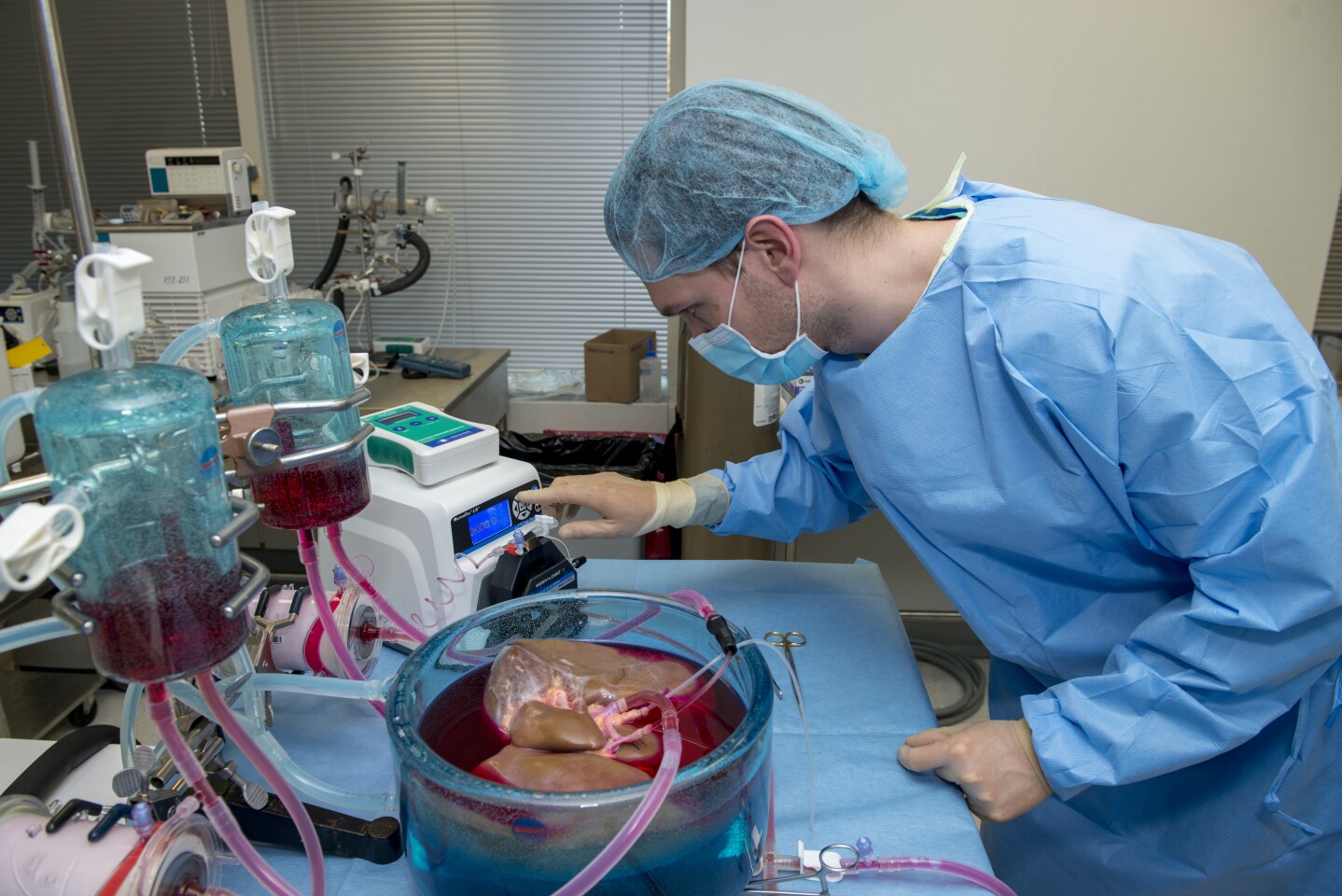 A new supercooling technique could greatly improve outcomes by taking donated organs into the realm of subzero temperatures for the first time