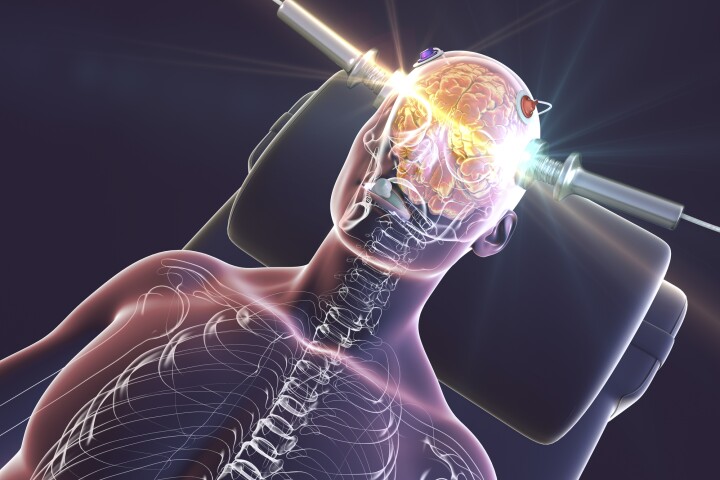 Two studies have looked at why electroconvulsive therapy is an effective treatment for severe depression