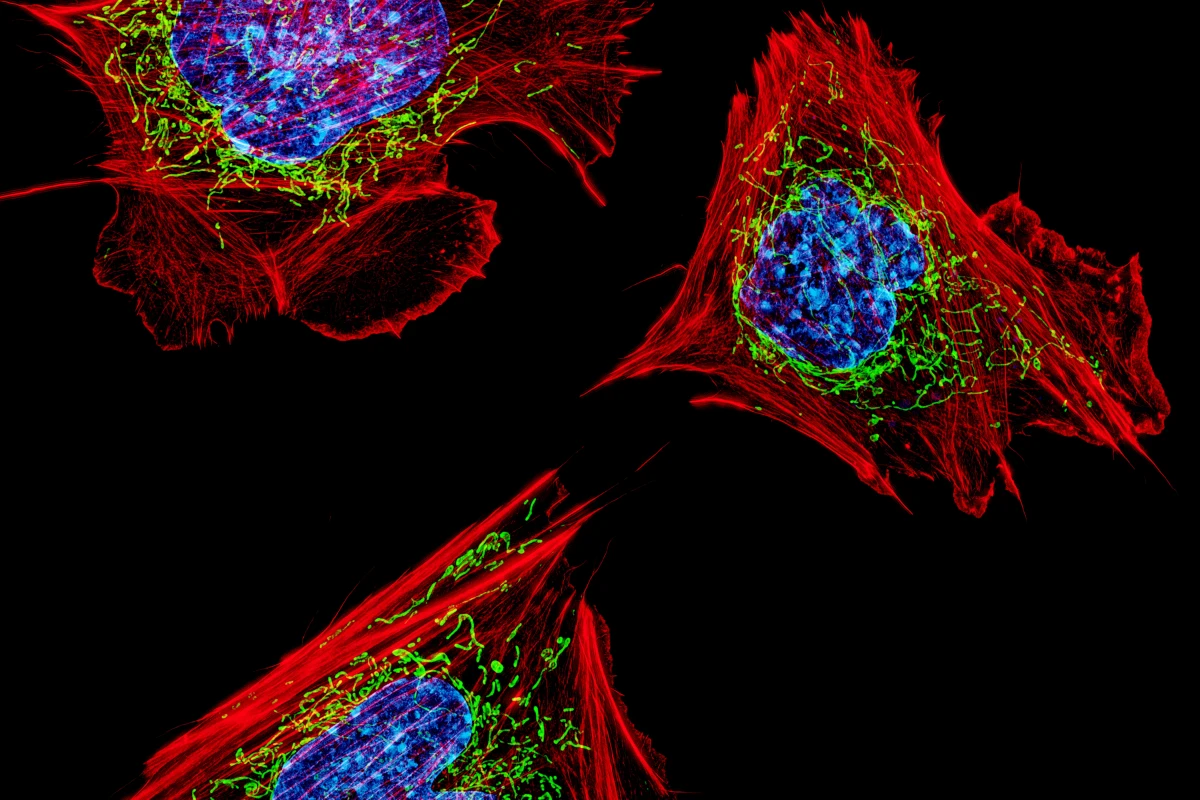 New research has found that a cell's mitochondria (represented in green above) can be affected through fasting which results in better health and longevity
