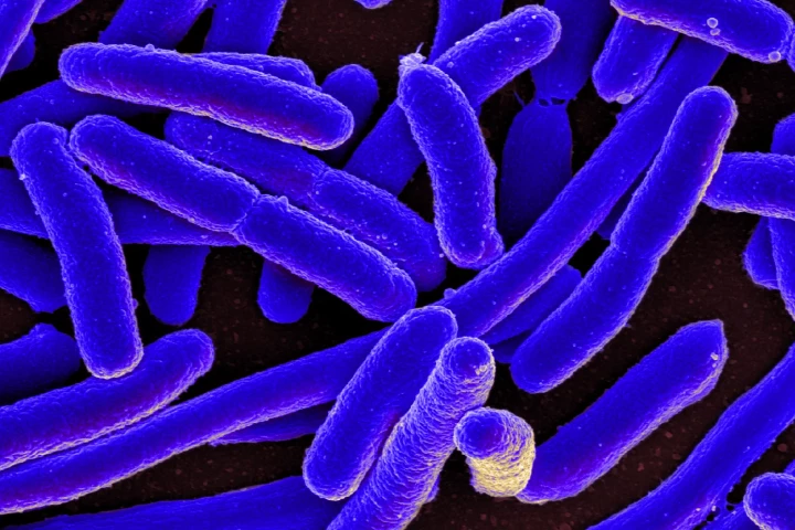 In a proof-of-concept study, scientists at the University of Granada have shown how an ancestral protein dating to as far back as four billion years can protect E. coli from a bacteria-infecting virus
