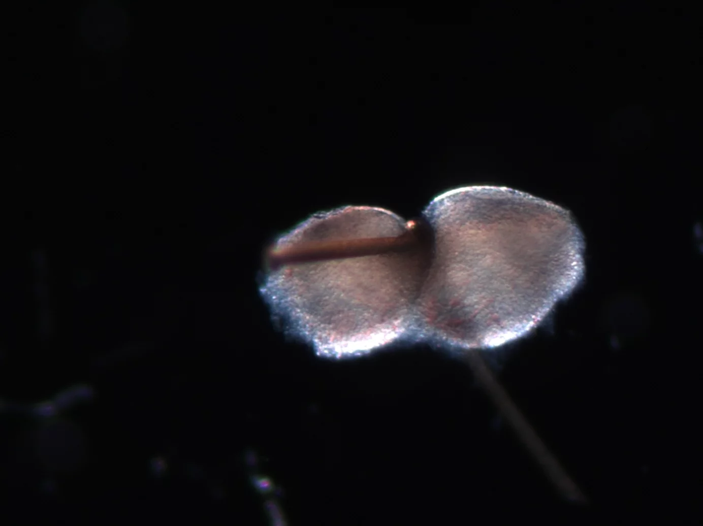 A tooth germ being split in two