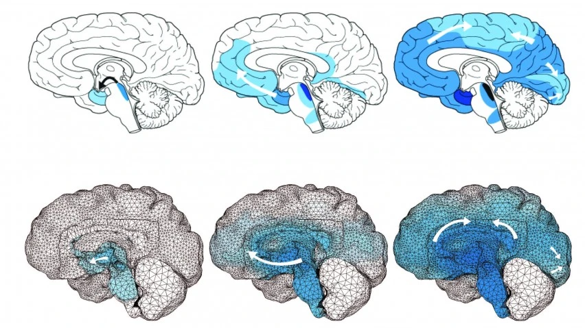 The above model shows how toxic tau proteins spread throughout the brains of patients with Alzheimer's disease