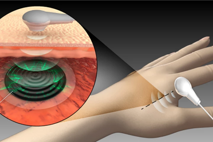 A new technology developed at King Abdullah University of Science and Technology could enable for implanted medical devices to be powered wirelessly with ultrasound
