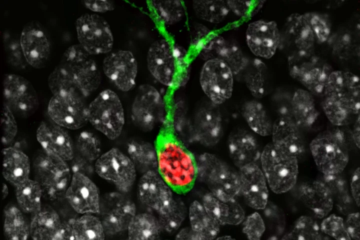 The green shows a cell active when recalling a traumatic memory, the red is a cell following trauma therapy. The study shows where in the brain traumatic memories can be specifically rewritten to eliminate negative responses