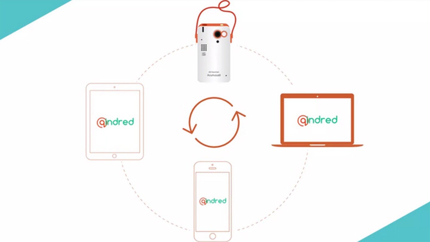 The QindredCam lifelogging camera will upload content to the Qindred cloud service whenever it's connected to Wi-Fi