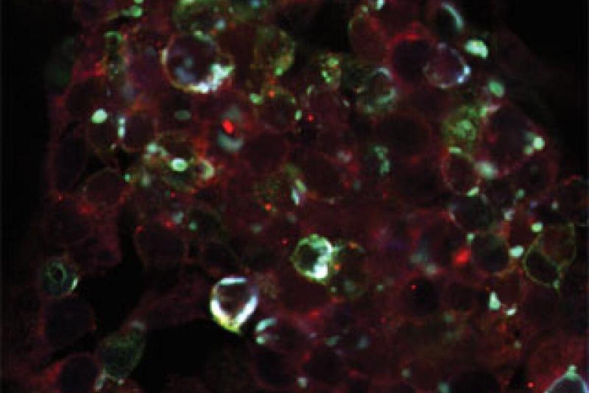 Scientists reduce blood sugar levels in mice by remote control
