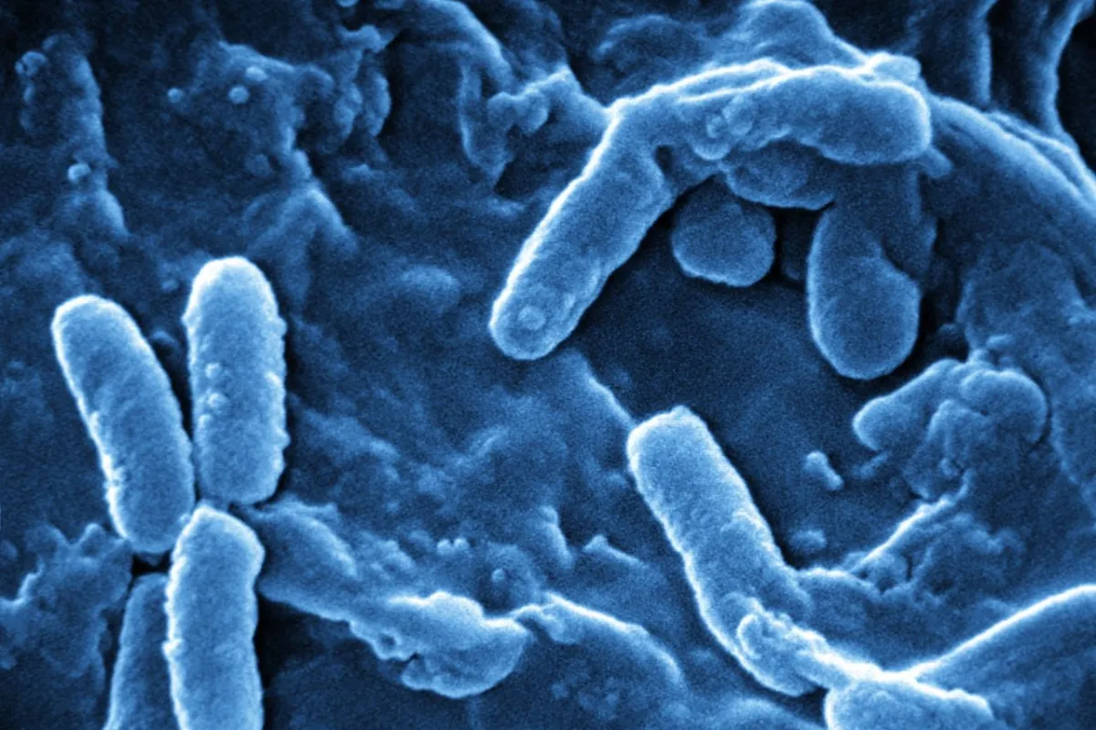 Blue light has been used to kill potentially-lethal Pseudomonas aeruginosa bacteria (pictured) in the skin and soft tissues of lab mice
