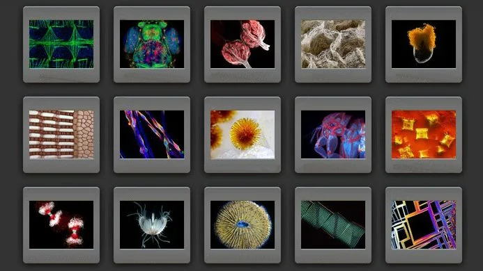 The winners of the 36th Nikon Small World Photomicrography Competition have now been announced