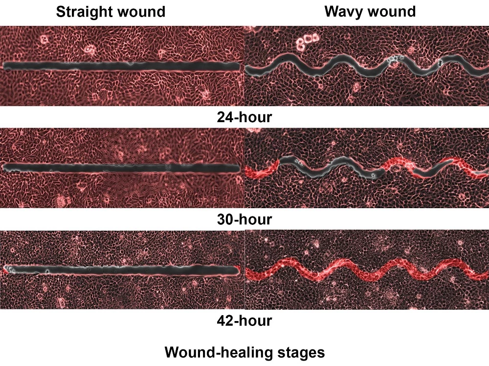 One example of how a wavy wound healed considerably faster than a straight one of the same size