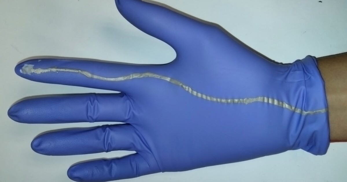 Pressure-sensing glove may help reduce stillbirths in developing nations Pressure-sensing glove may help reduce stillbirths in developing nations