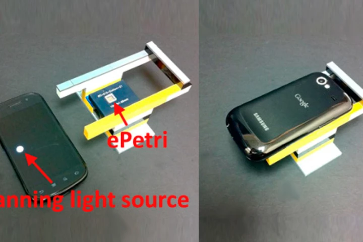 The ePetri prototype uses an image sensor and a smartphone's LED display as a scanning light source (Image: Guoan Zheng, California Institute of Technology)