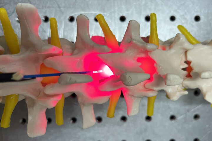 Direct red-light therapy improved spinal injuries