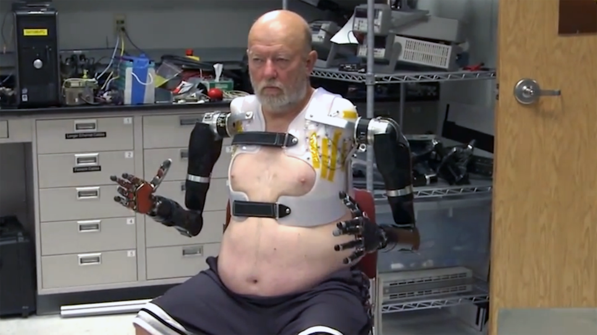 To allow Mr. Baugh to control the limbs, a custom socket was created for the top half of his torso