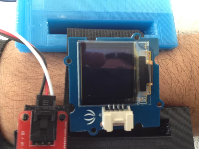 The group hopes to develop a consumer version of the Glove Tricorder that doesn't require a physician for an accurate diagnosis