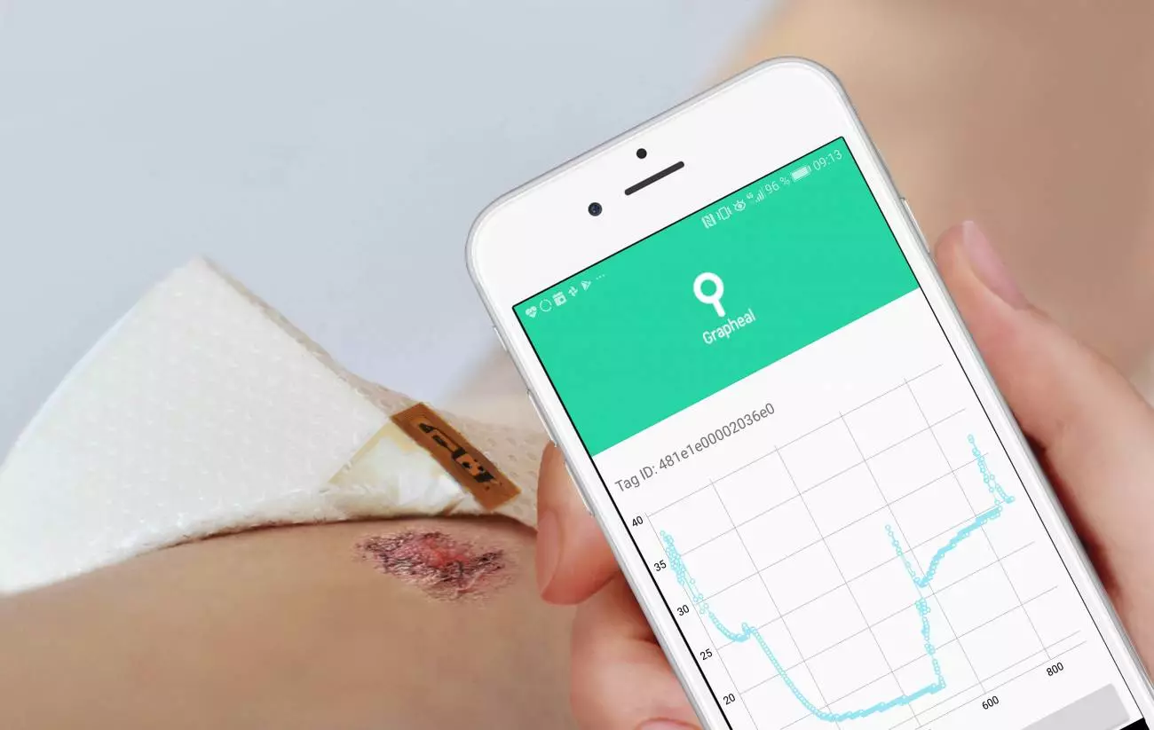 The status of chronic wounds can be checked using an online portal